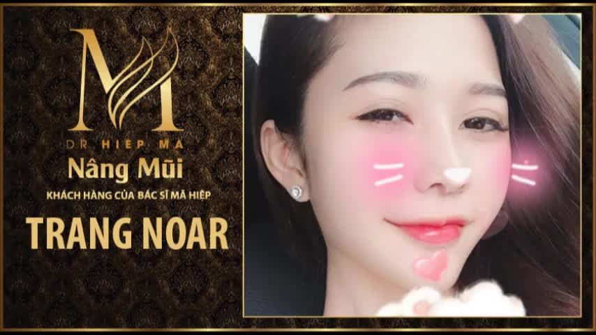 Nâng mũi - Bác sĩ Mã Hiệp - Ca 52