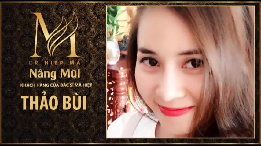 Nâng mũi - Bác sĩ Mã Hiệp - Ca 44