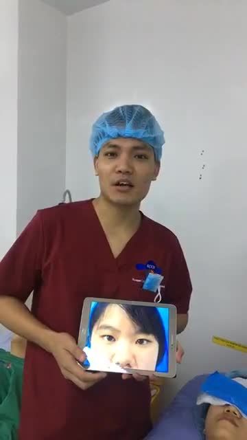 Cắt mí plasma + mở góc mắt trong - Thẩm mỹ Kangnam - Ca 12