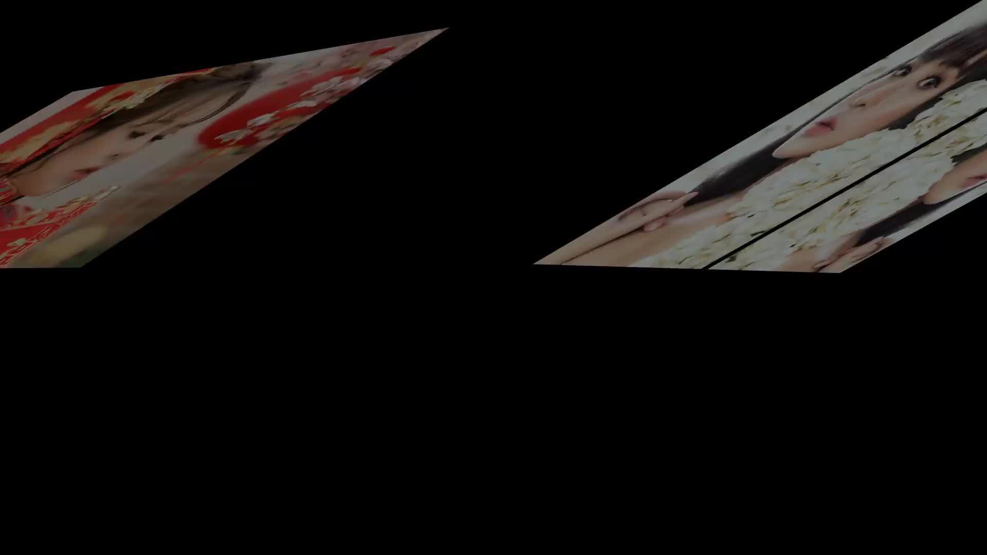 Nâng mũi - Bác sĩ Mã Hiệp - Ca 35