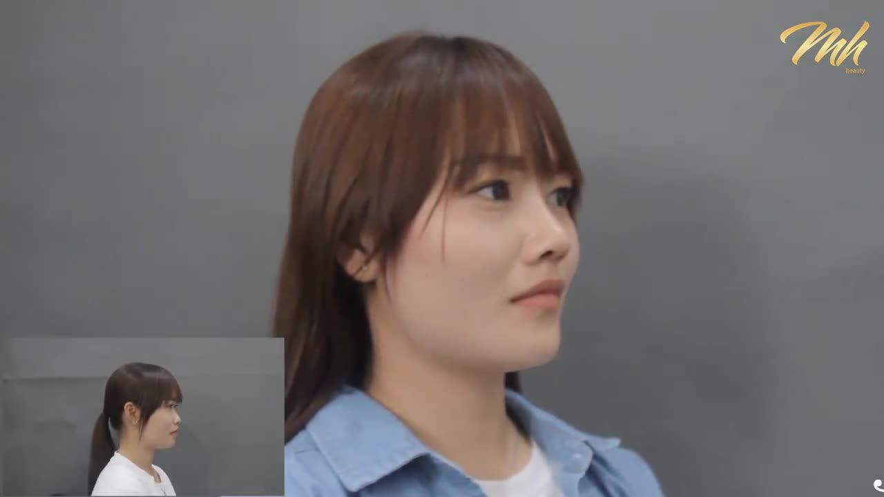 Nâng mũi - Thẩm mỹ viện MH Beauty - Ca 09