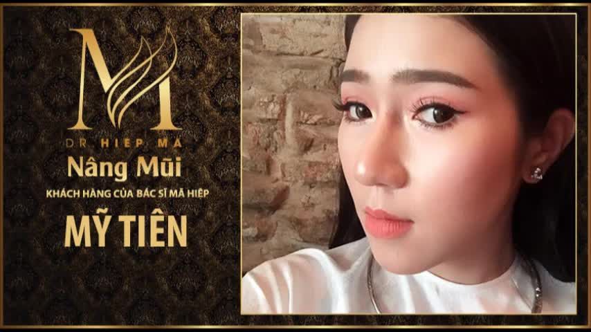 Nâng mũi - Bác sĩ Mã Hiệp - Ca 57