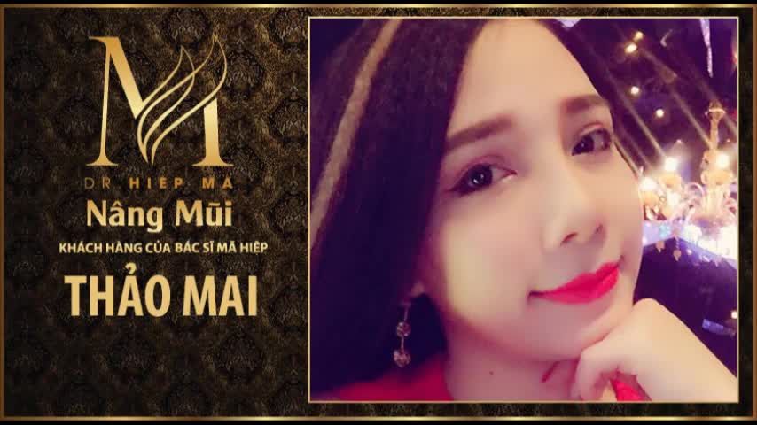 Nâng mũi - Bác sĩ Mã Hiệp - Ca 59