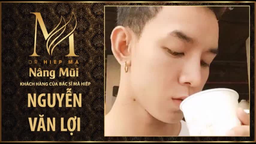 Nâng mũi - Bác sĩ Mã Hiệp - Ca 56