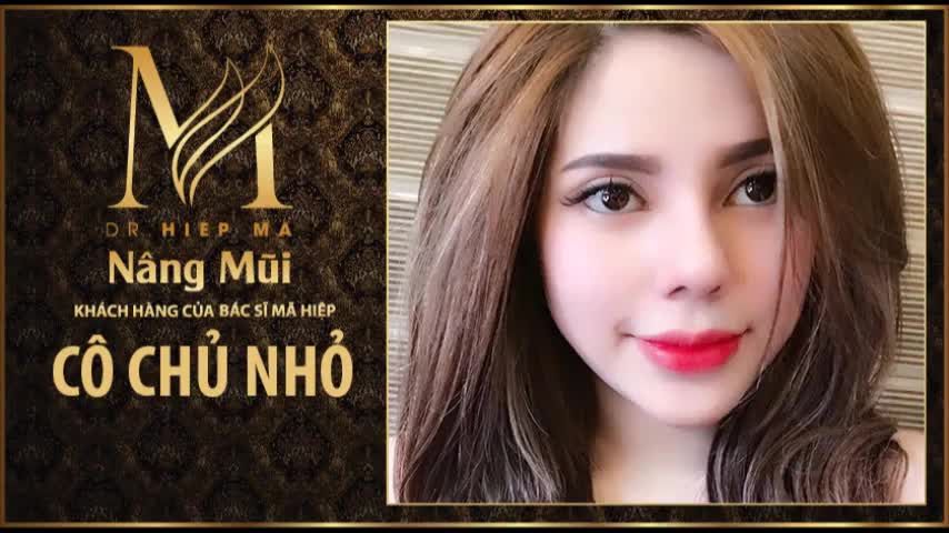 Nâng mũi - Bác sĩ Mã Hiệp - Ca 61