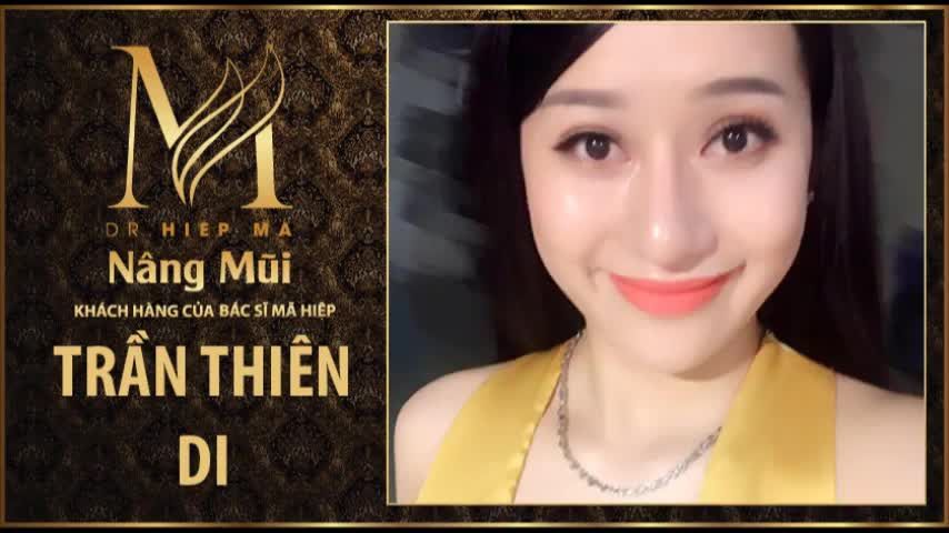 Nâng mũi - Bác sĩ Mã Hiệp - Ca 53