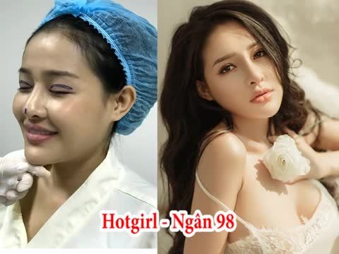 Hình ảnh hoa hậu Kỳ Duyên, hoa hậu Kim Ngọc sau phẫu thuật thẩm mỹ toàn diện