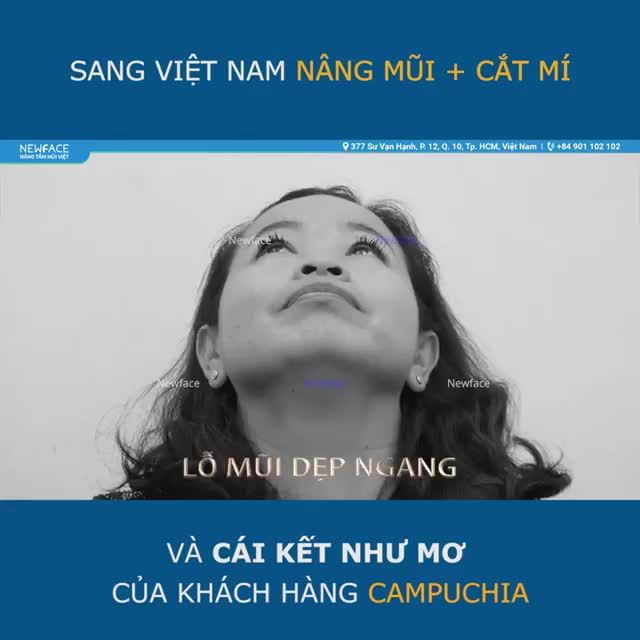 LẶN LỘI TỪ CAMPUCHIA SANG VIỆT NAM NÂNG MŨI + CẮT MÍ - CHỊ CHANDARY ĐÃ CÓ MỘT CÁI KẾT NHƯ MƠ - BS Trần Phương