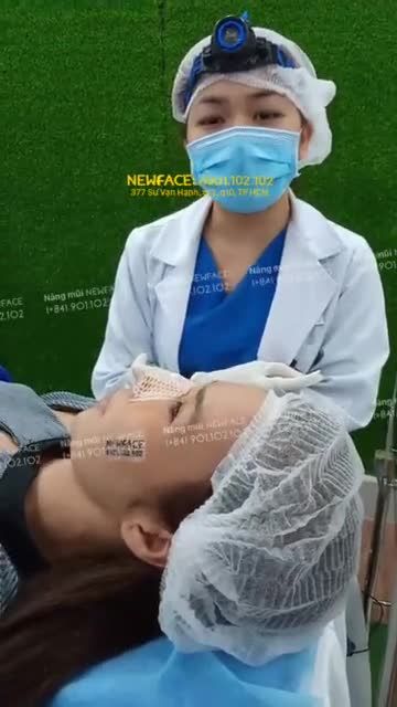 Nâng mũi cấu trúc sườn Gore-tex, sau phẫu thuật 7 ngày - Bs Trần Phương