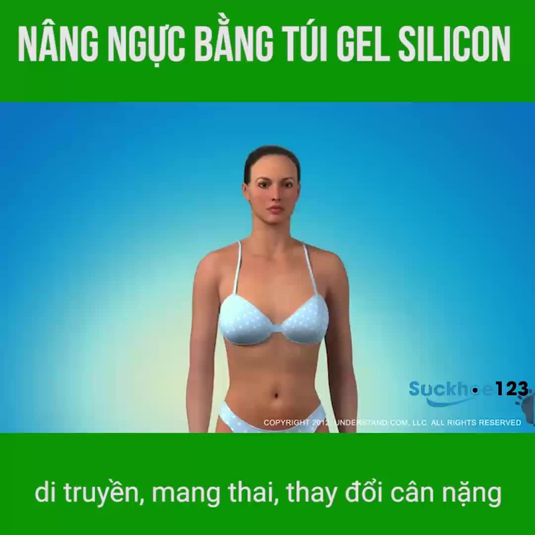 Nâng ngực bằng túi gel silicone - Dr Tâm