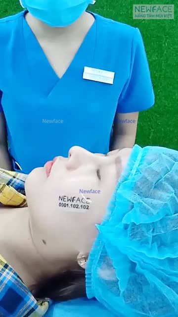 BẤT NGỜ VỚI DIỆN MẠO MỚI CỦA BẠN THU HƯƠNG SAU 14 NGÀY NÂNG MŨI SỤN SƯỜN