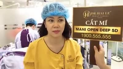 Ca mí siêu khó với tình trạng mí thừa, sụp lại thiếu mỡ nhưng đã được khắc phục