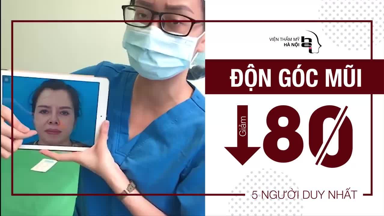 CHỈ VỚI 5 NGƯỜI MAY MẮN DUY NHẤT: Giảm 80 % dịch vụ độn góc mũi tại viện thẩm mỹ Hà Nội
