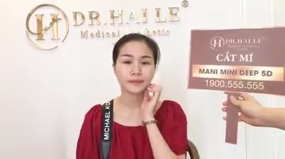 Cắt mí giúp bạn sở hữu đôi mắt 2 mí to tròn nhanh chóng và không lộ dấu vết thẩm mỹ