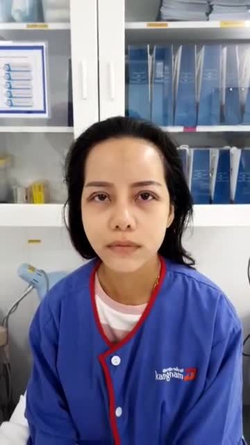 Khách hàng cắt mí trên tạo nếp mí