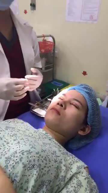 Tái khám cắt chỉ sau 5 ngày cắt mí trên plasma