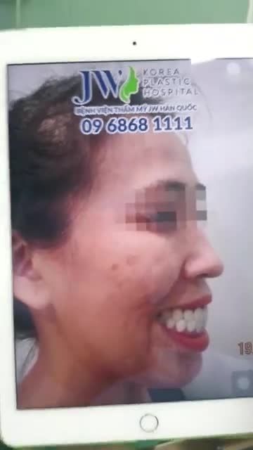 CÔ GÁI HÀM HÔ VÀ CÁI KẾT SAU KHI "THAY ĐỔI SỐ PHẬN" TẠI BỆNH VIỆN JW