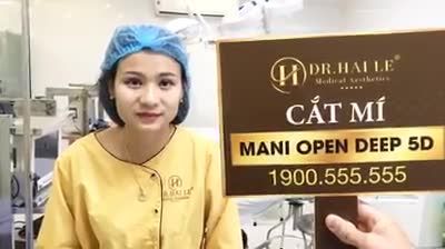 Cùng xem sự thay đổi sau khi cắt mí Mani Open deep 5D vừa thực hiện xong