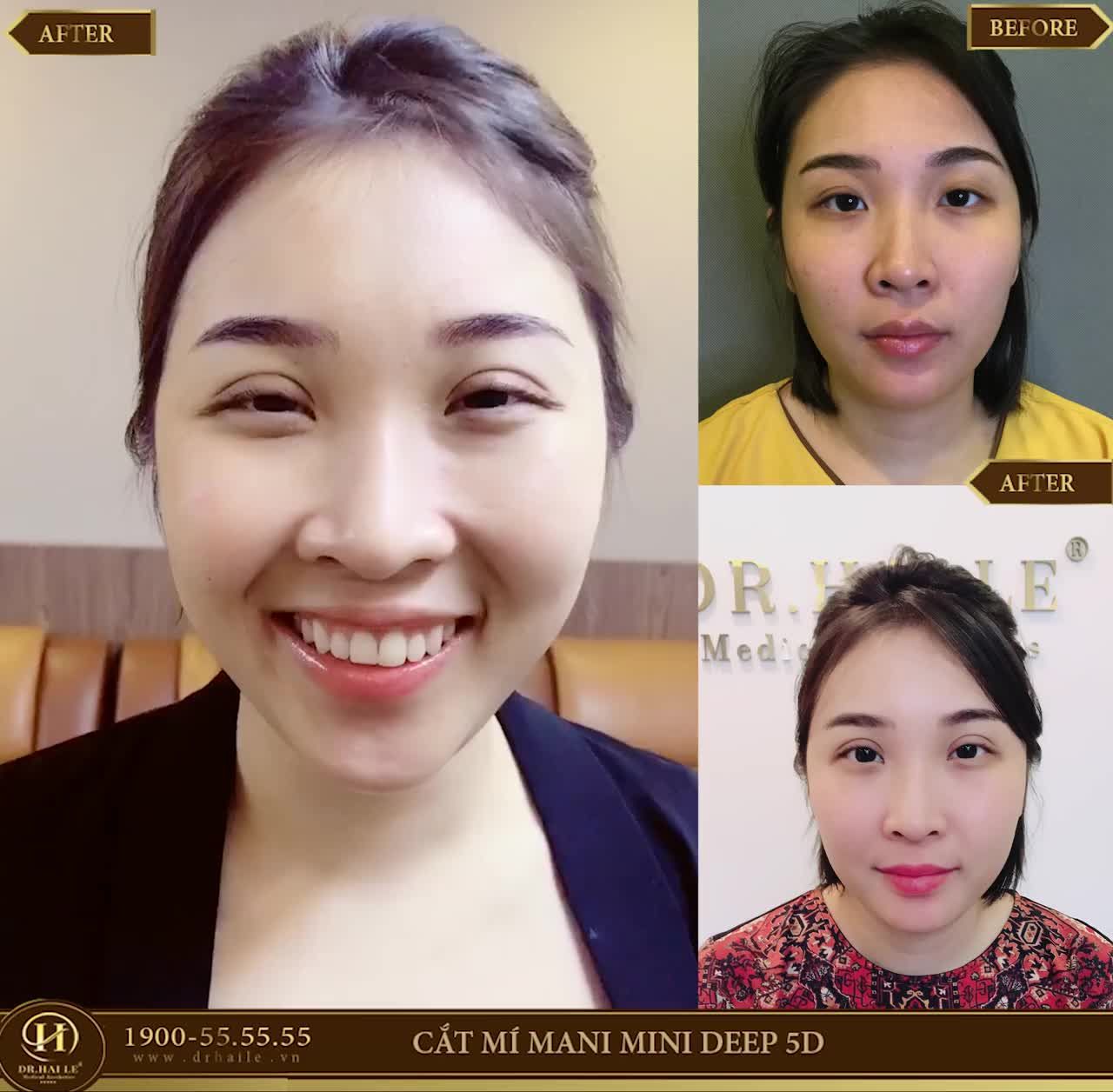 Cười hết cỡ nhưng mắt vẫn to tròn long lanh