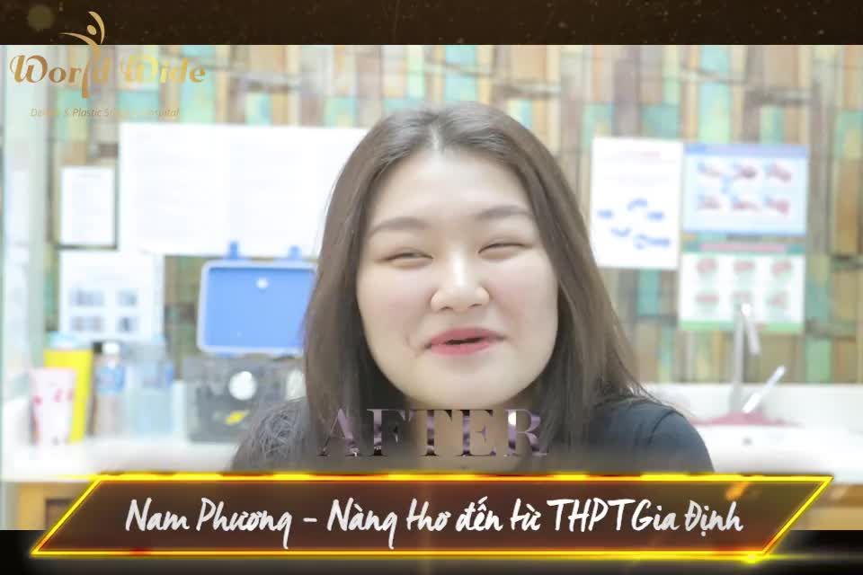 Lời nhắn gửi dễ thương của khách hàng khi kết thúc hành trình niềng răng 2 năm của mình teamniengrang