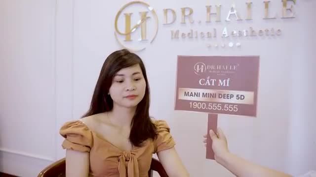 Em gái sở hữu mắt đẹp xinh tươi sau 1 tuần thực hiện Cắt mí Mani Mini Deep 5D
