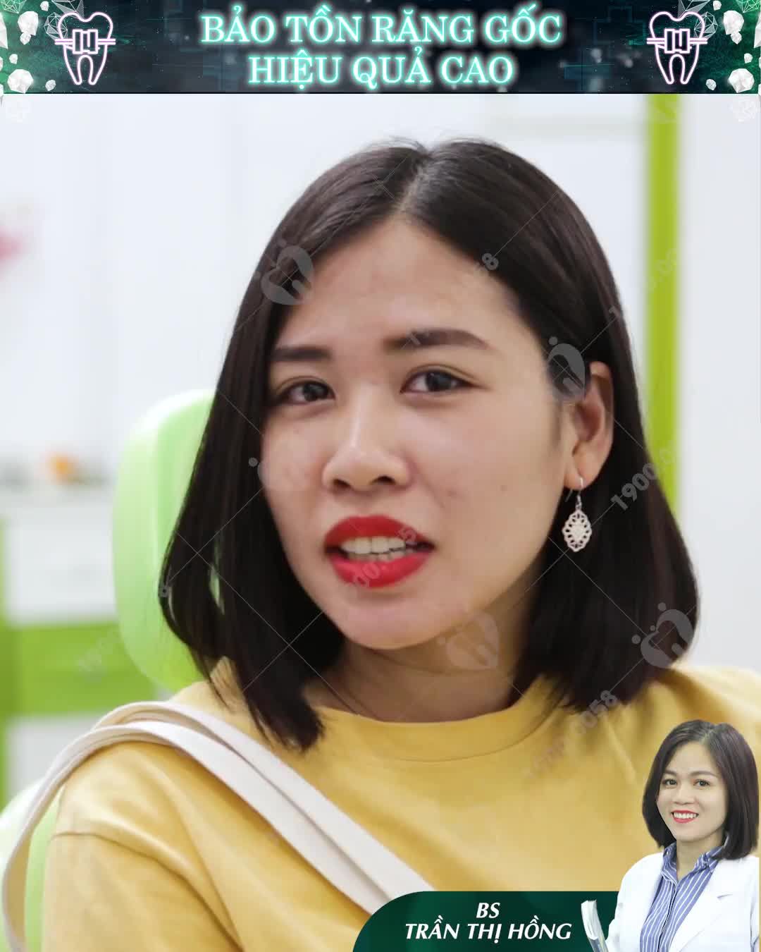 TOP 4 CA NIỀNG RĂNG THÀNH CÔNG TẠI NHA KHOA GIA ĐÌNH