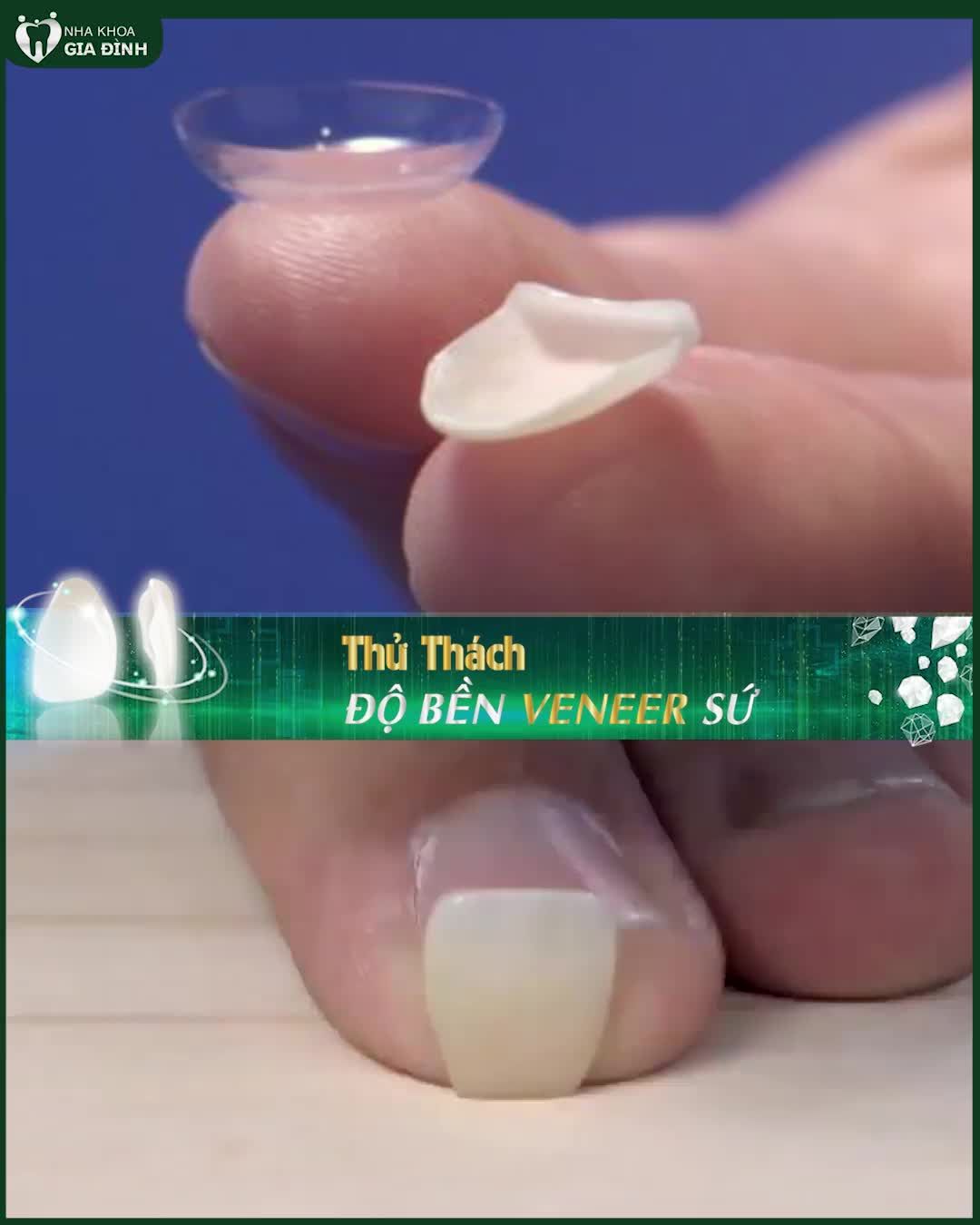 THỬ THÁCH ĐỘ BỀN CỦA VENEER SỨ