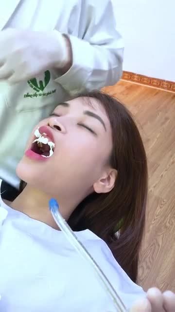 [Livestream] CASE KHÁCH HÀNG DÁN 20 VENEER kết hợp làm 4 CHỤP SỨ - Chị Phương Anh