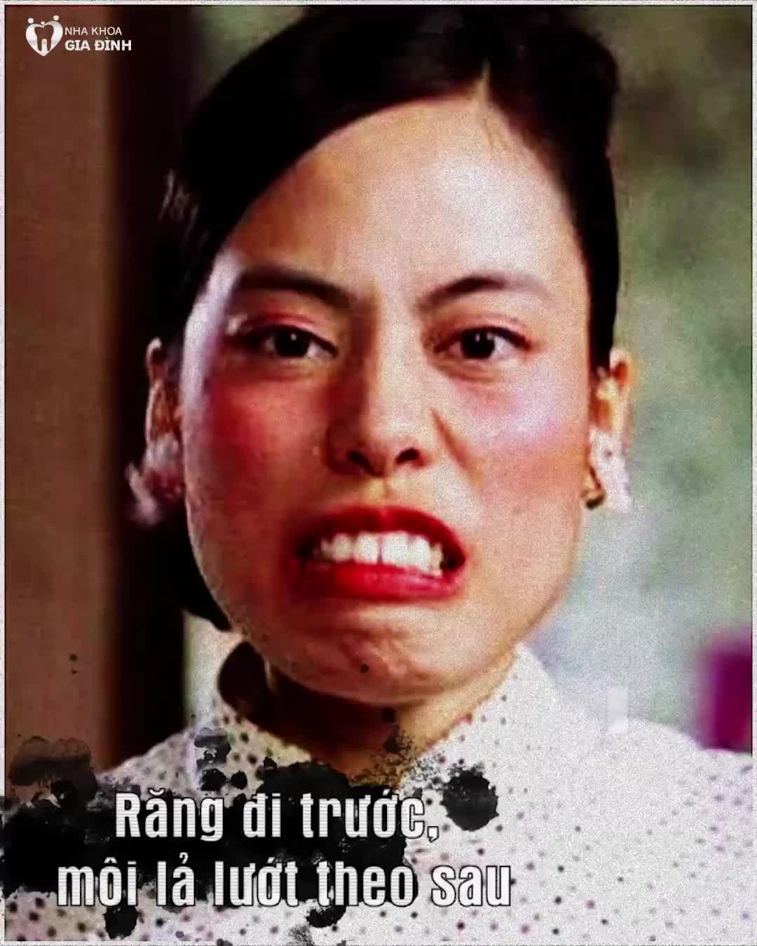 RĂNG HÔ KHIẾN BẠN TỰ TI, BỊ NHIỀU NGƯỜI CHÊ CƯỜI