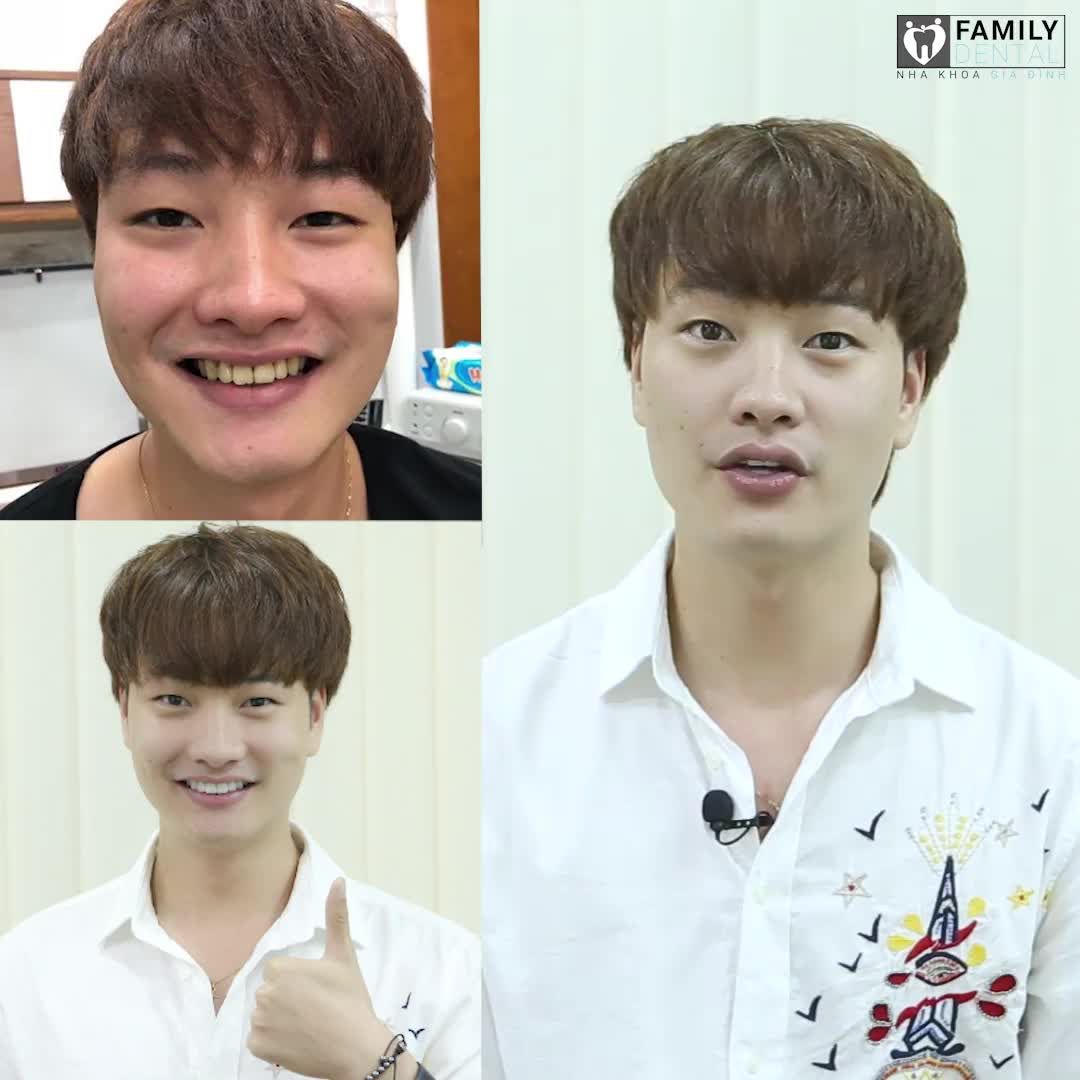 DIỄN VIÊN TRỌNG LÂN TỰ TIN, RẠNG NGỜI VỚI NỤ CƯỜI TRẮNG SÁNG