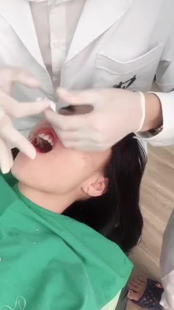 (LIVESTREAM): Trực Tiếp Ca Dán 8 Veneer Sứ - Chị Tố Nga