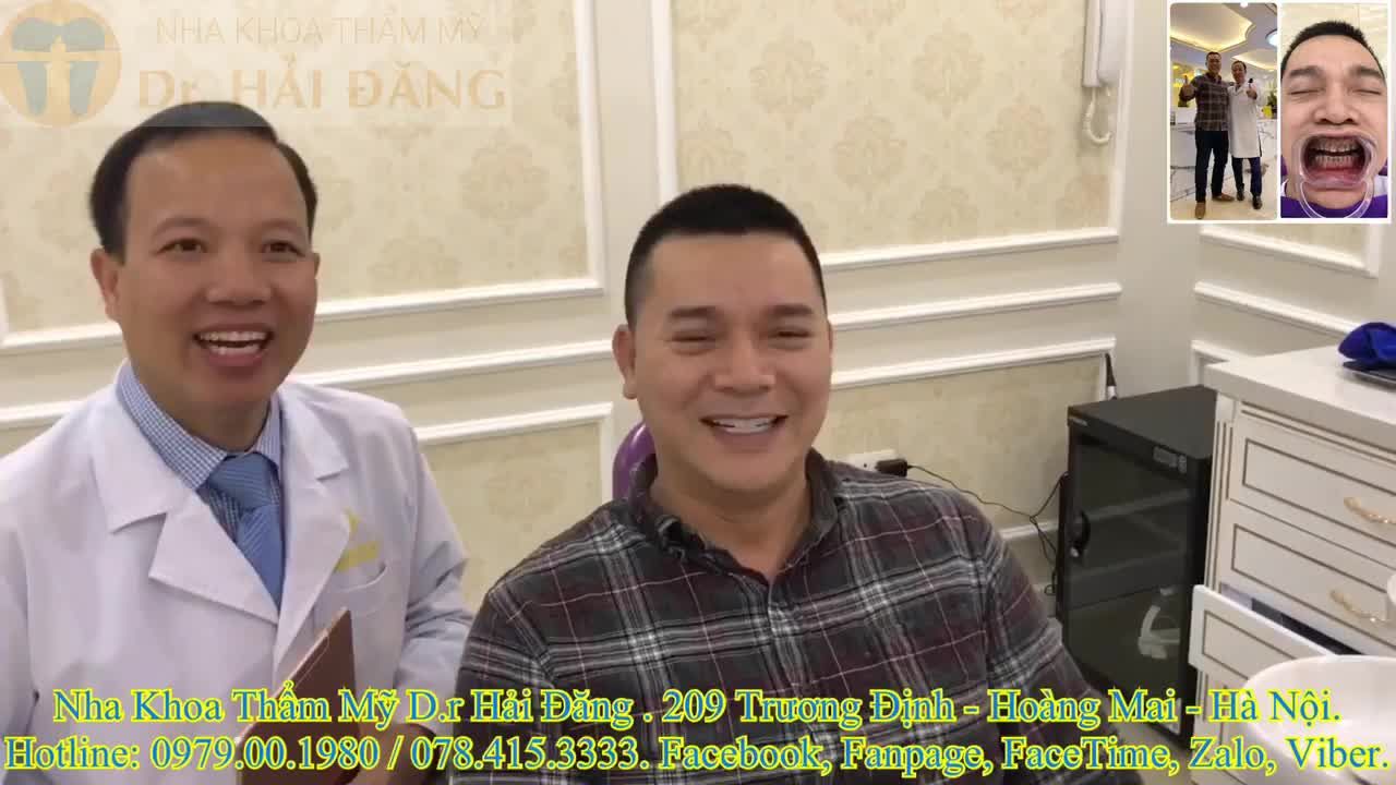 Sự chia sẻ cảm nhận của khách hàng sau khi làm 20 răng sứ thẩm mỹ