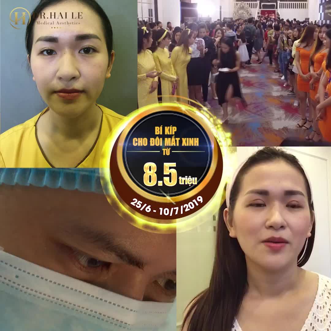 Hàng ngàn khách hàng đã tin tưởng và trải nghiệm dịch vụ cắt mí tại Dr. Hải Lê