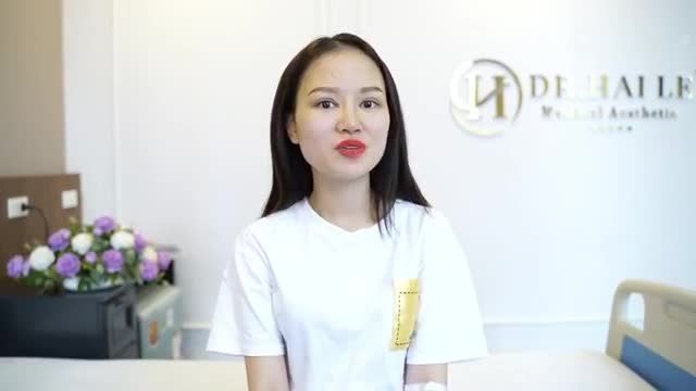 HOA HẬU TRÍ TUỆ Thùy_Linh chia sẻ cảm nhận sau Cắt mí tại Dr.Hải Lê