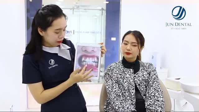 [TRỰC TIẾP] Chia sẻ cảm nhận khách hàng về dịch vụ niềng răng tại Nha Khoa Thẩm Mỹ Quốc Tế Jun Dental