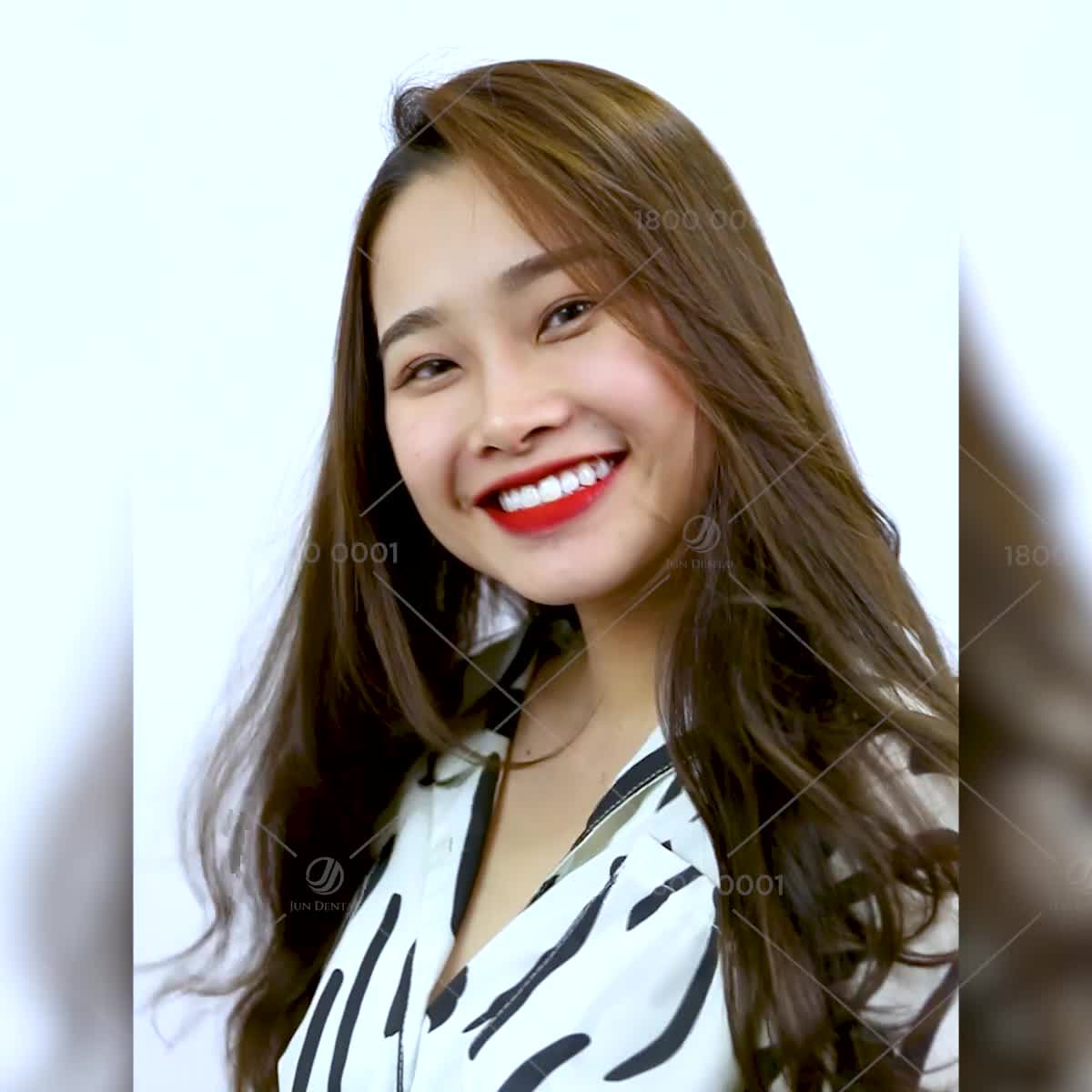 30 PHÚT CHO 1 NỤ CƯỜI XINH!! NGẠI GÌ KHÔNG TẨY TRẮNG?