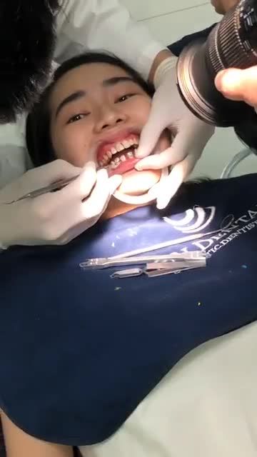 Livestream: Cận cảnh gắn mắc cài kim loại tại Jun Dental