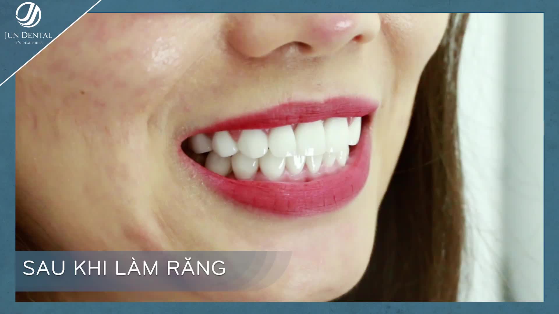 Nụ cười không chỉ tốt cho sức khỏe mà trong những mối quan hệ xã hội