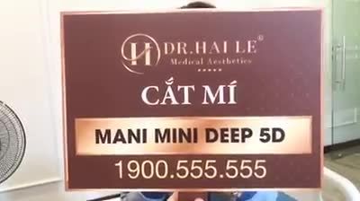 Em gái Lê Huế đến từ Quảng Ninh chia sẻ kết quả Cắt mí sau 7 ngày thực hiện sửa lại mí đã nhấn bị hỏng