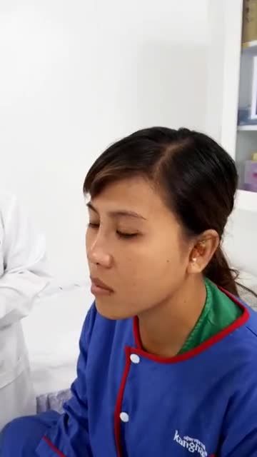 Khách hàng nâng mũi Sline 4D