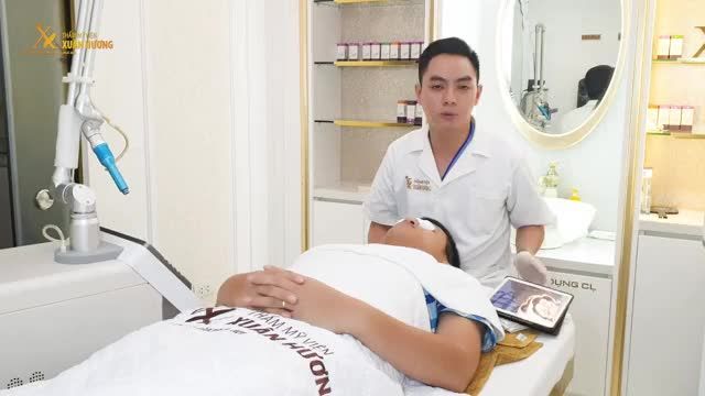 KIỂM CHỨNG SỨC MẠNH KHỬ THÂM CỦA MATRIXELL TRÊN MÔI KHÁCH HÀNG NAM