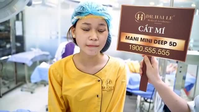 Mắt một mí, mí xếch trở nên 2 mí rạng ngời tươi trẻ sau 30 phút thực hiện Cắt mí Mani Mini Deep 5D
