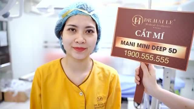 MC Đài TH Quân Đội Bích_Thảo vô cùng bất ngờ sau khi Cắt mí Mani Open Deep 5D và nhận được kết quả đẹp ngoài sự mong đợi