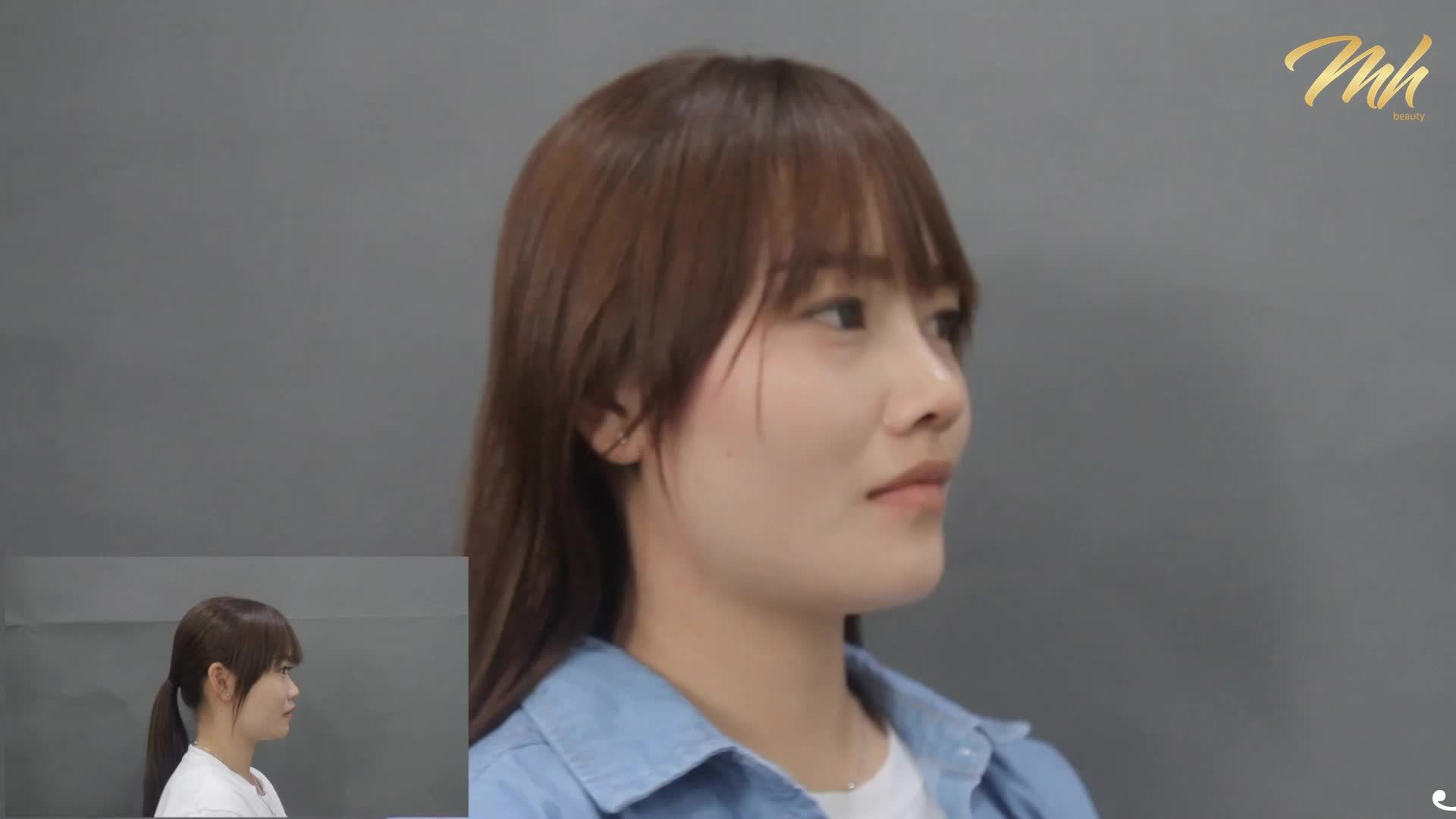 MŨI CAO SANG CHẢNH - ĐẸP KHÔNG GÓC CHẾT