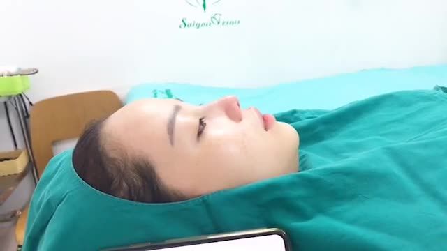 NÂNG MŨI BỌC SỤN - GIẢM GIÁ ĐẶC BIỆT TRONG THÁNG 8