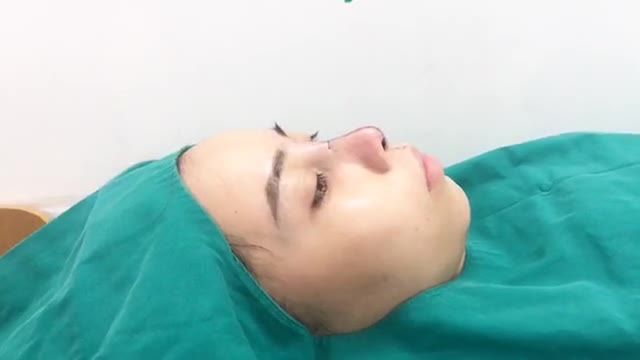 NÂNG MŨI BỌC SỤN KẾT HỢP BỌC CÂN THÁI DƯƠNG