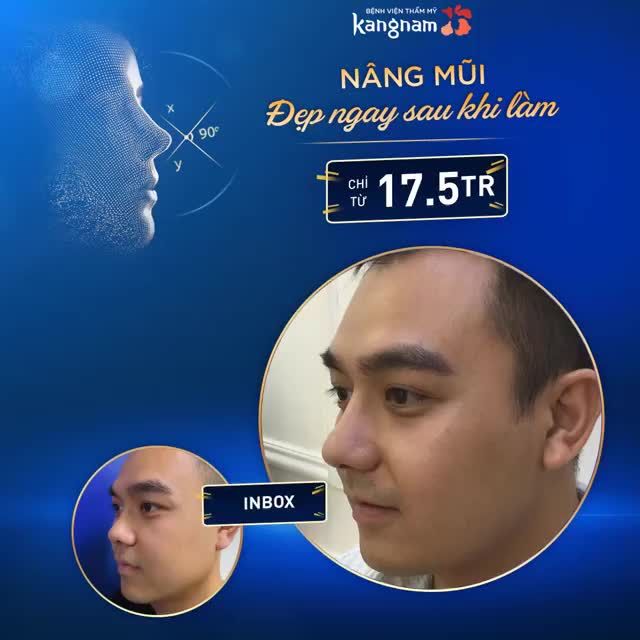 SỞ HỮU MŨI ĐẸP NGAY SAU KHI LÀM