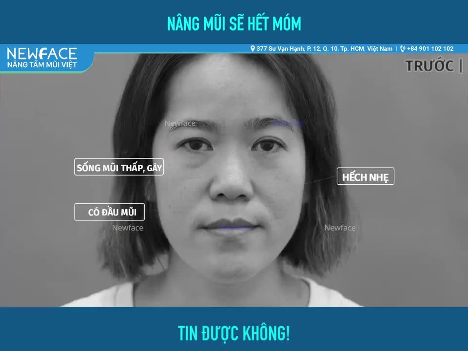 NÂNG MŨI SẼ HẾT CẰM LƯỠI CÀY - BẠN TIN KHÔNG?