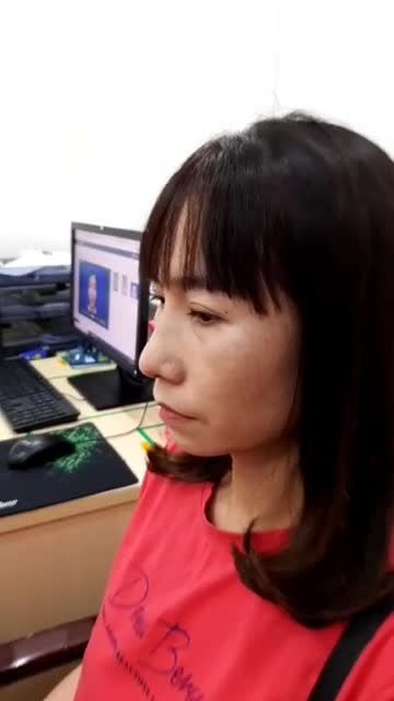 Khách hàng nâng mũi sụn sườn Nanoform