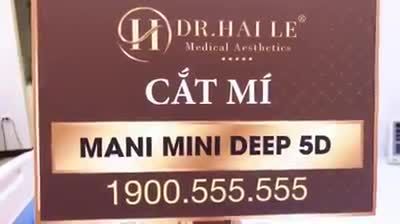Cắt mí Mani Mini Deep 5D - cùng xem sự thay đổi không ngờ của bạn nữ nay nhé